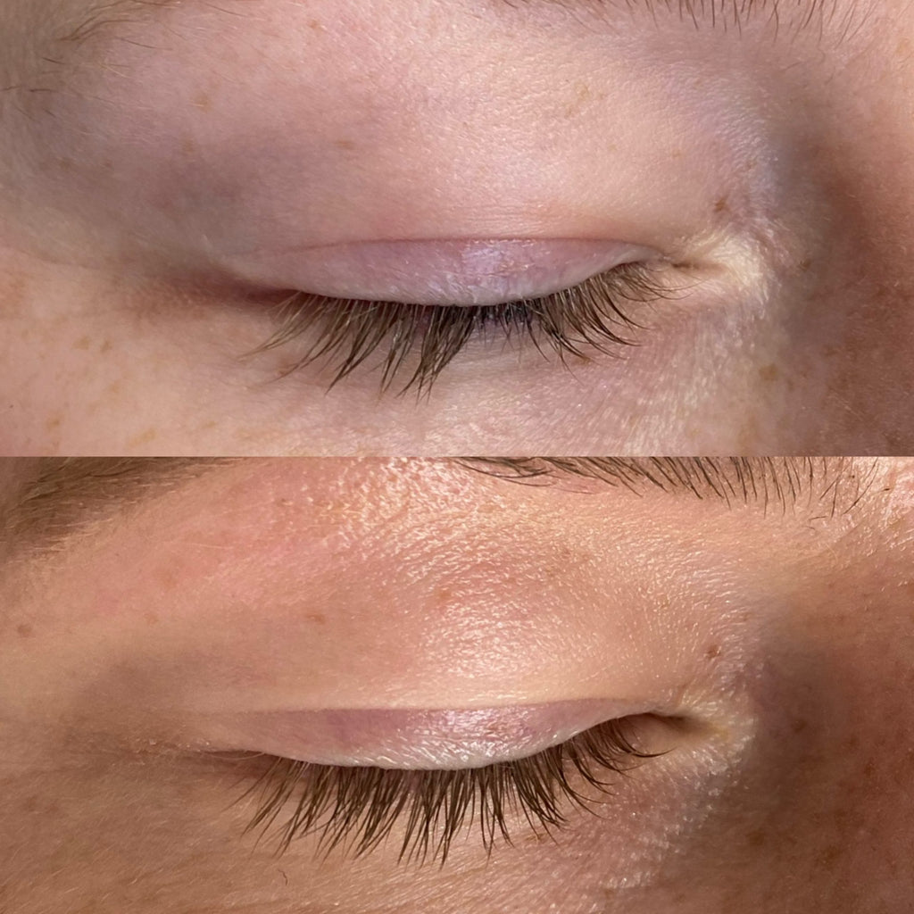 Brow & Lash Growth Bundle