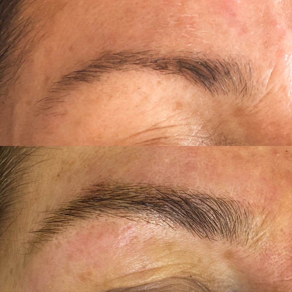 Brow & Lash Growth Bundle