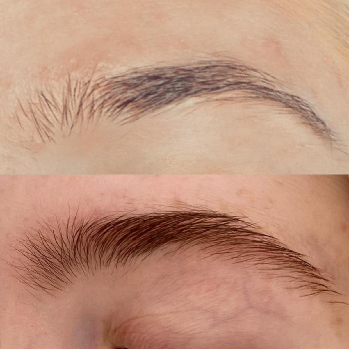 Brow Enhancer